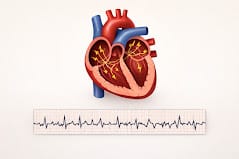 Atrial Fibrillation Irregular Heart Ecg