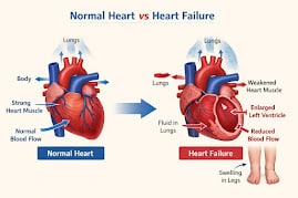 Normal Vs Heart Failure Comparison